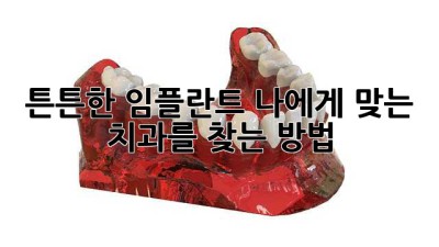 튼튼한 임플란트, 나에게 맞는 치과를 찾는 방법!